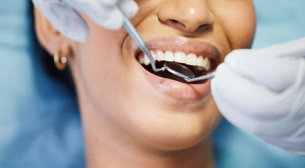 Best Emergency Denture Repair in Monona, WI